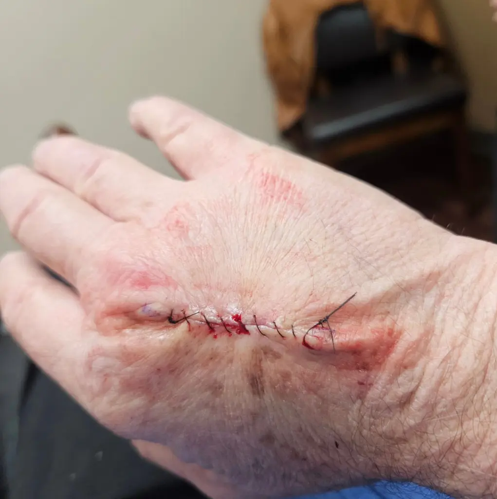 Шрам означает, что боль прошла Шрам означает, что боль прошла