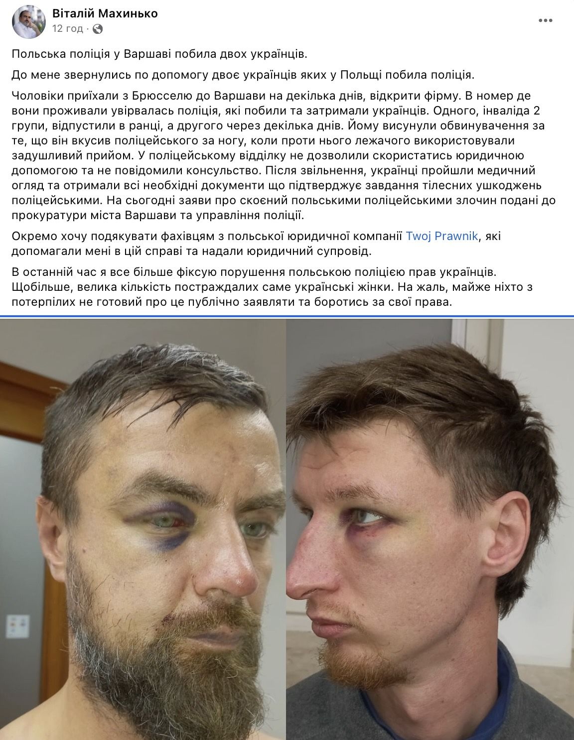 Побиття українців у Польщі Побиття українців у Польщі