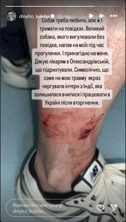 Дмитро Кулеба звернувся до лікарів через укуси собаки Дмитро Кулеба звернувся до лікарів через укуси собаки