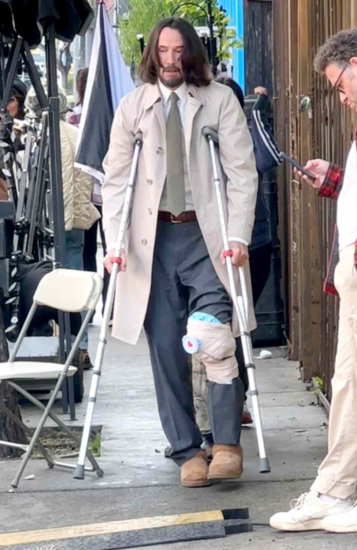 Мое колено! Мое колено!