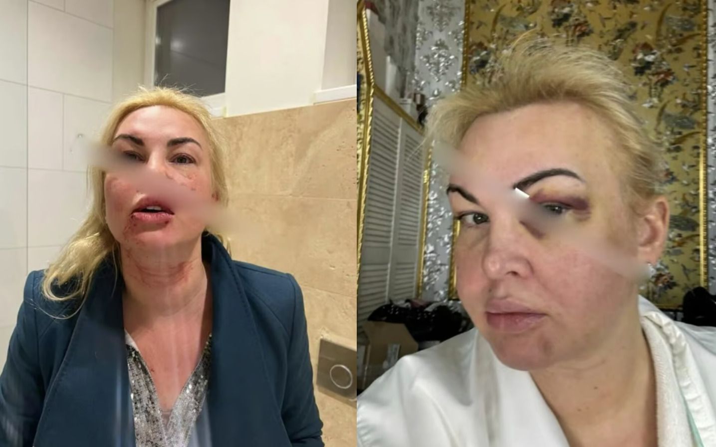 Певца утверждает, что эти фото не реальны и отрицает избиение Певца утверждает, что эти фото не реальны и отрицает избиение