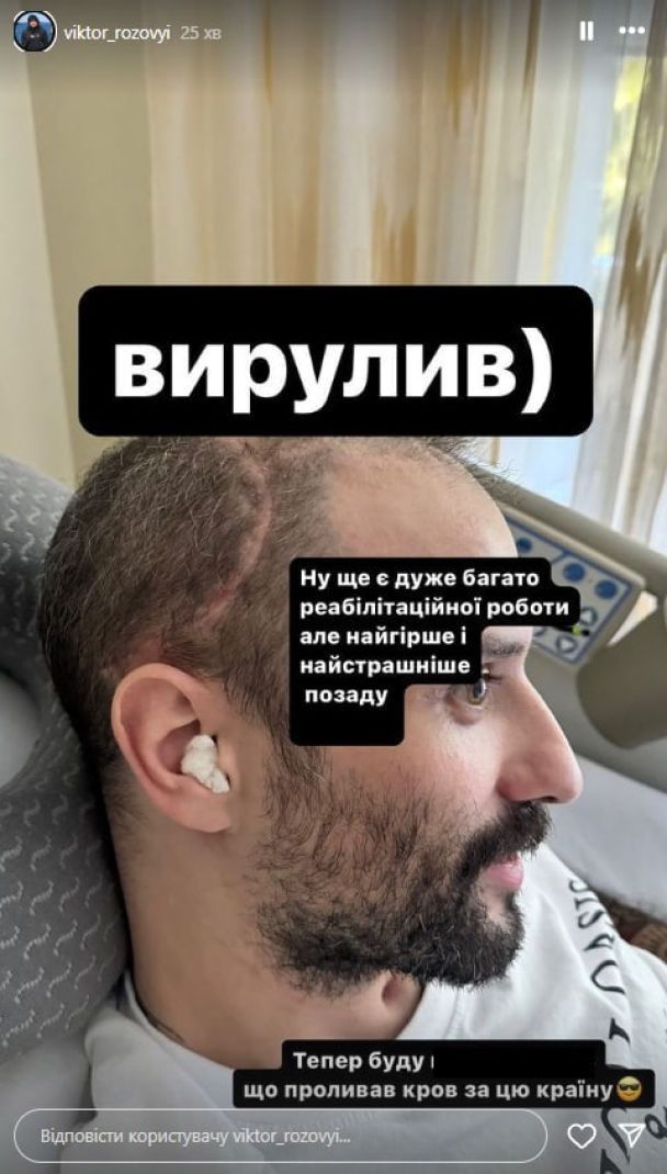 Самое страшное позади: звезда Лиги смеха впервые показал себя после тяжелого ранения на фронте 1