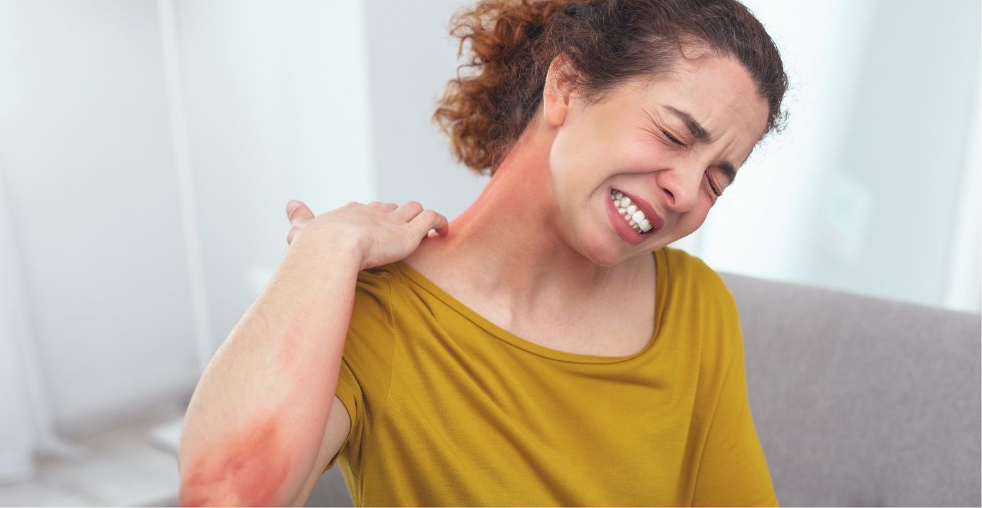 Аллергия - какая бывает и как ее диагностировать 2