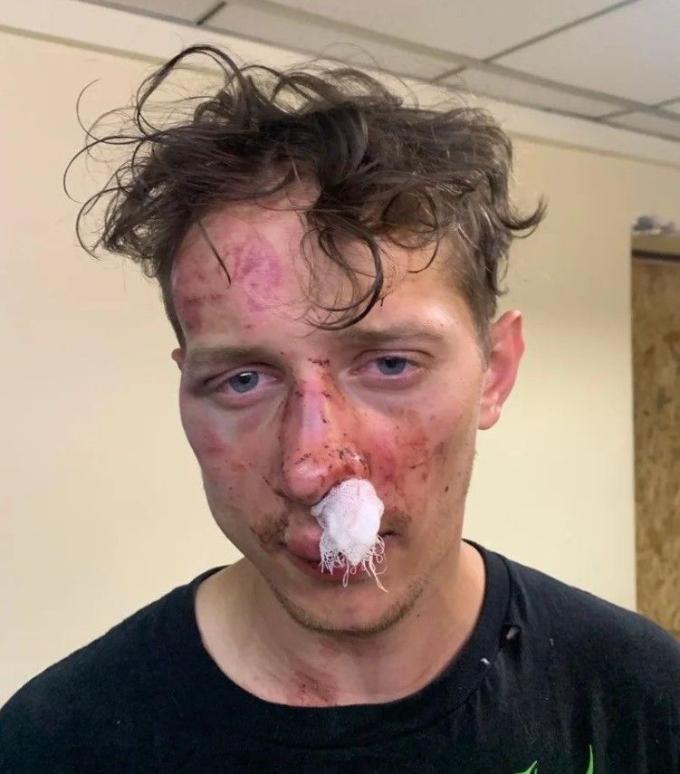 Три голи від Румунії на Євро-2024, союз Путіна та Кім Чен Ина, : ключові події та скандали тижня 2