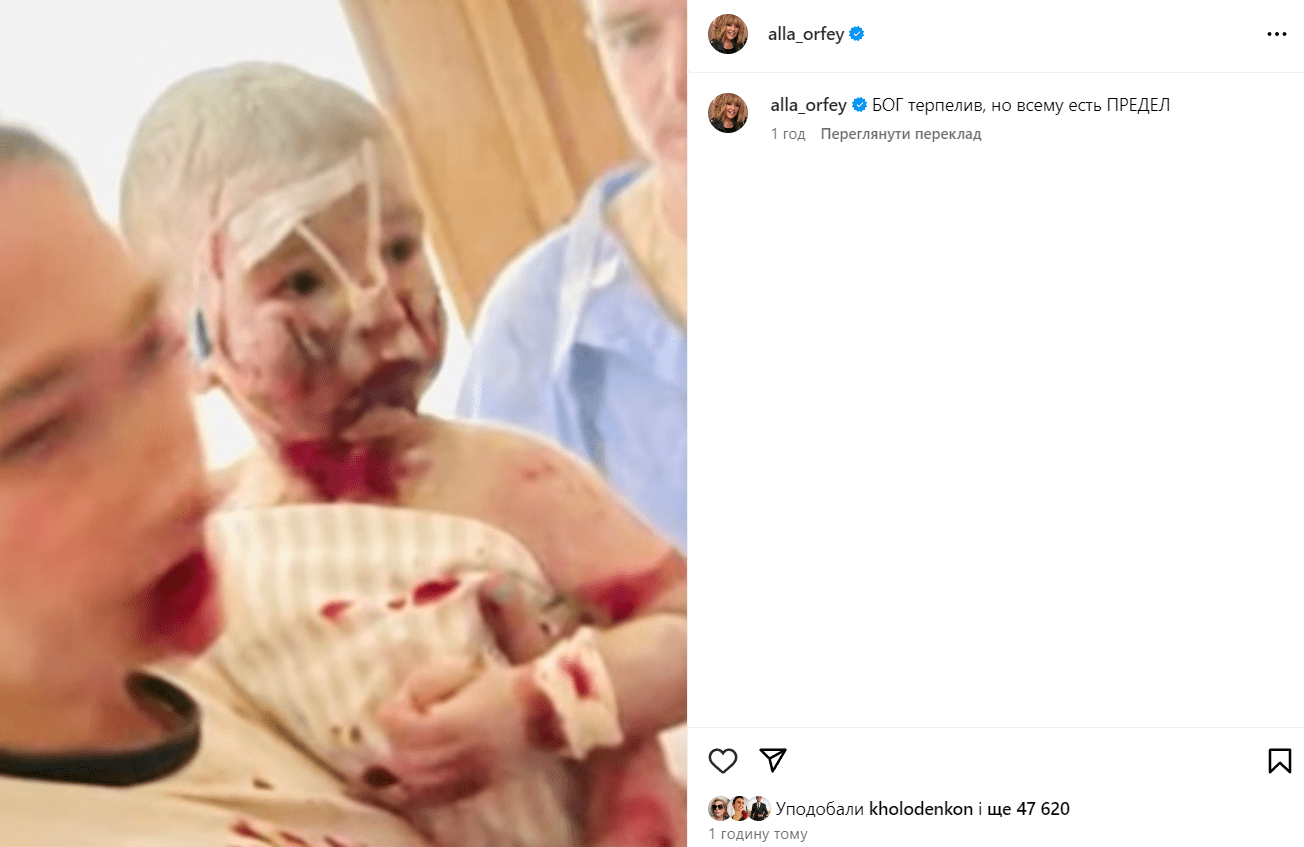 Реакція Алли Пугачової на обстріл "Охматдиту" Реакція Алли Пугачової на обстріл "Охматдиту"