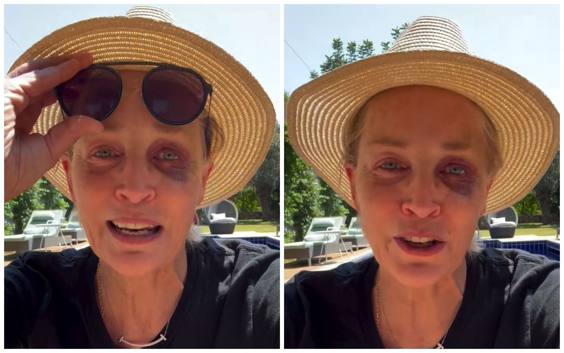Хороший фингал. Фото: Instagram/sharonstone Хороший фингал. Фото: Instagram/sharonstone
