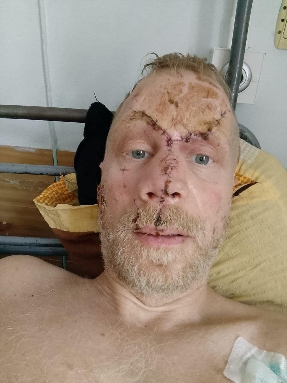 Офіцери поліції вже були у мене: поранений актор став жертвою шахраїв 1