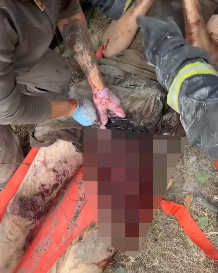 На месте было много тяжелораненых людей На месте было много тяжелораненых людей