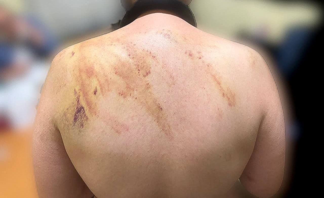 На Франковщине работница интерната избила подопечную: на скандал отреагировал Лубинец 1