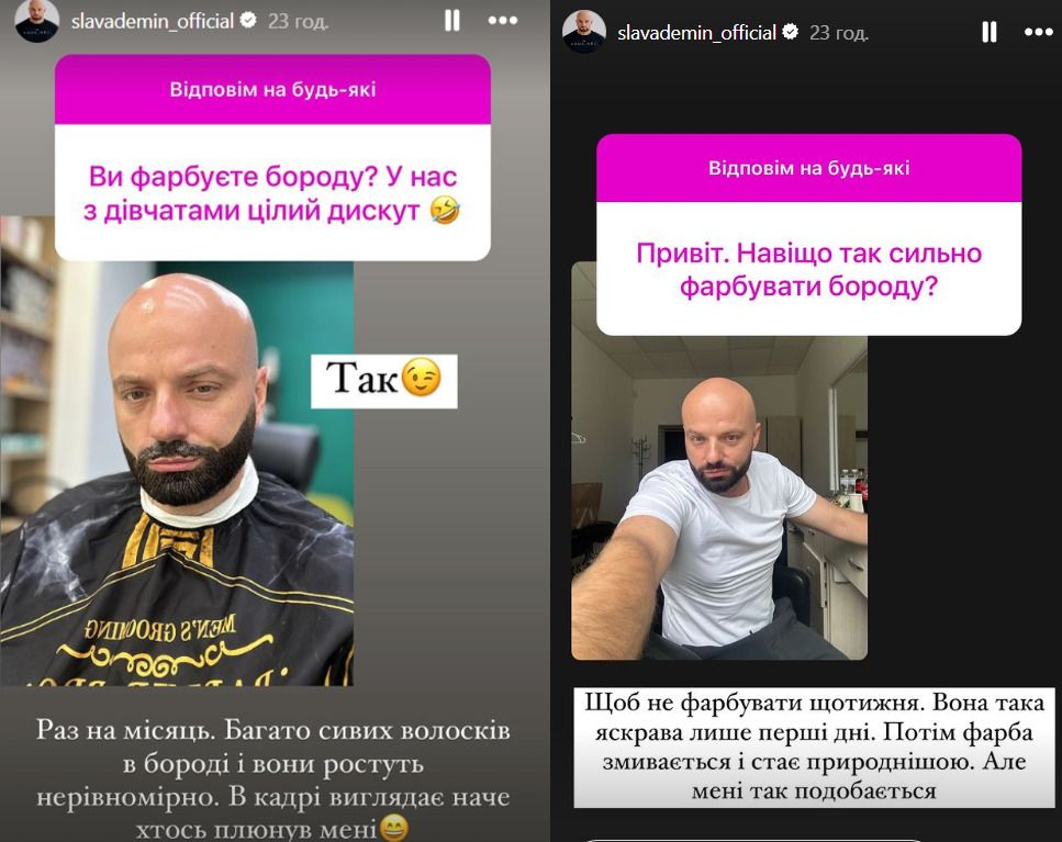 Слава Дьомін відверто про свій зовнішній вигляд Слава Дьомін відверто про свій зовнішній вигляд