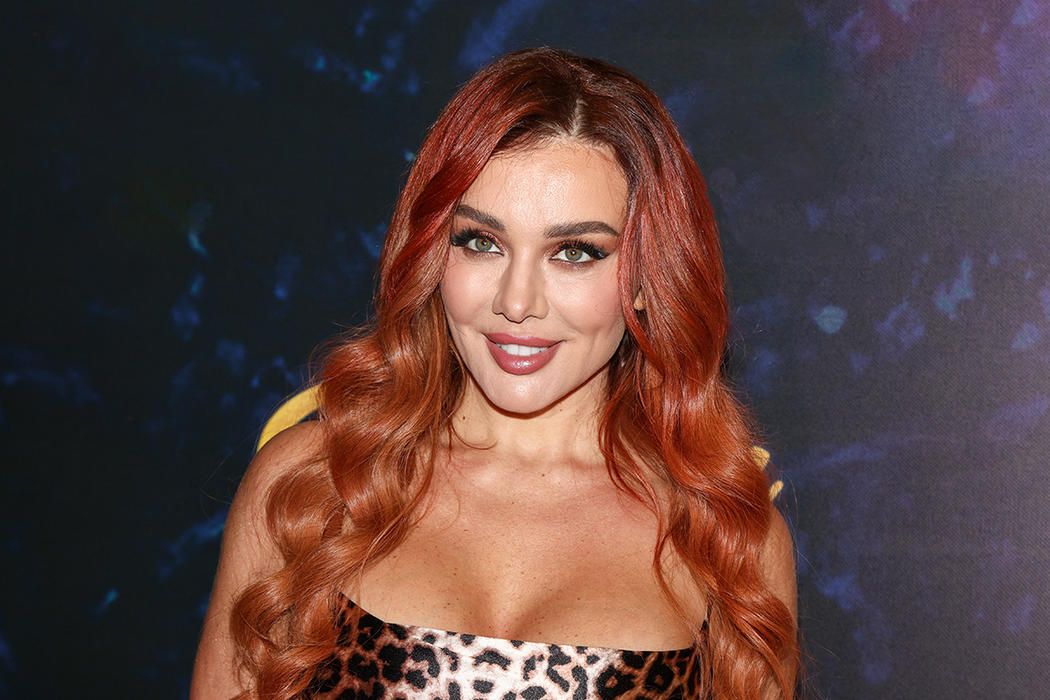 Наприкінці 2024 року зрадниця показала нове обличчя після пластики