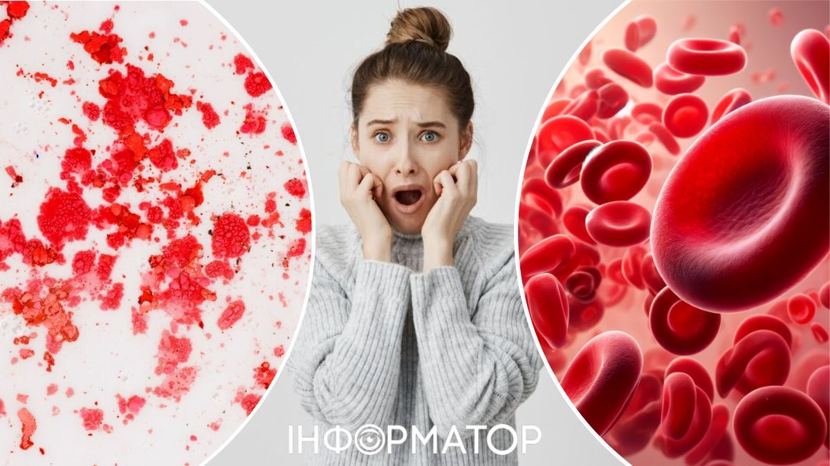 После лечения кровавый пот не исчез полностью.