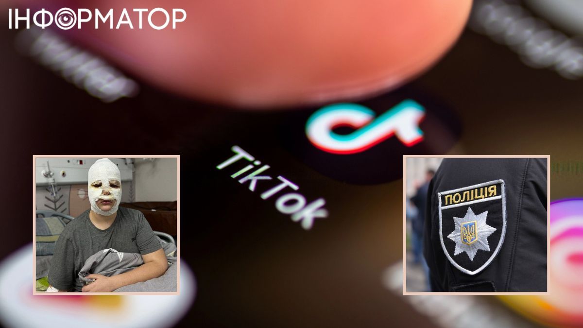 TikTok, опіки, діти, небезпечний тренд