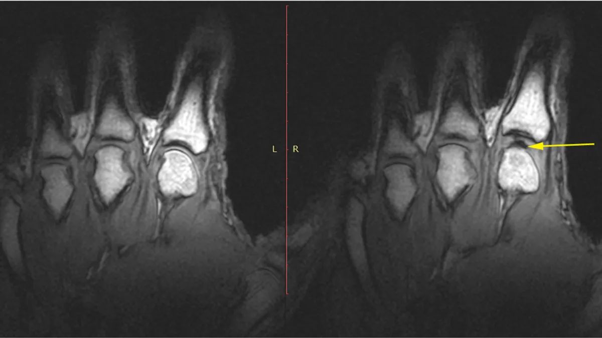 пальці рук 1