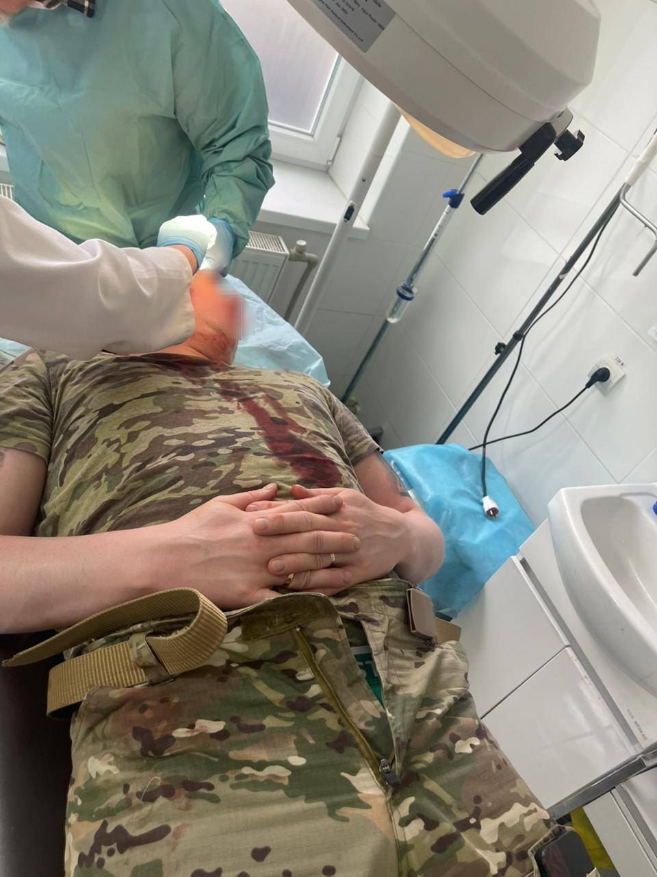 На Закарпатті роми напали на прикордонників, почалася стрілянина: є поранені 1