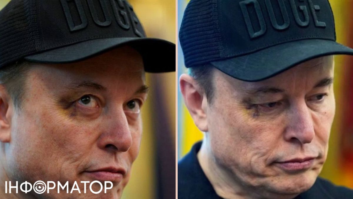 Маск прийшов на вечірку у Білий дім із синцем під оком