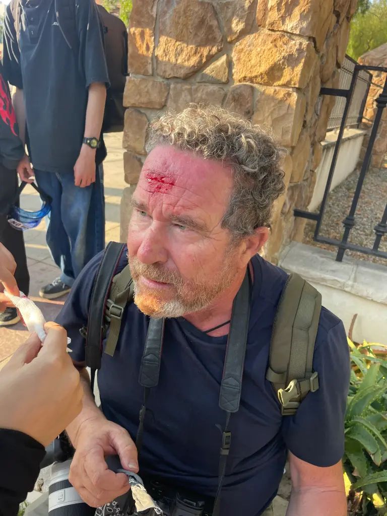 Раненый журналист Тоби Канхэм Раненый журналист Тоби Канхэм