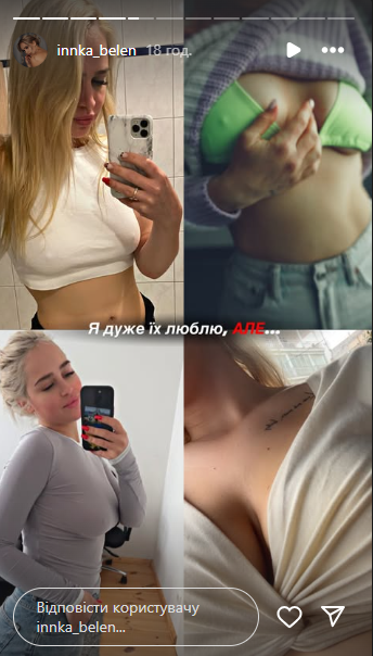 Інна Бєлєнь змінил форму та розмір грудей Інна Бєлєнь змінил форму та розмір грудей