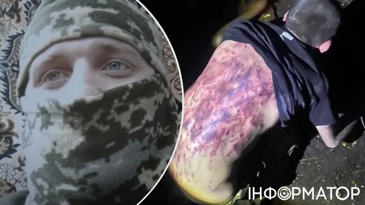 боец 57 ОМБр жалуется на побои и угрозы