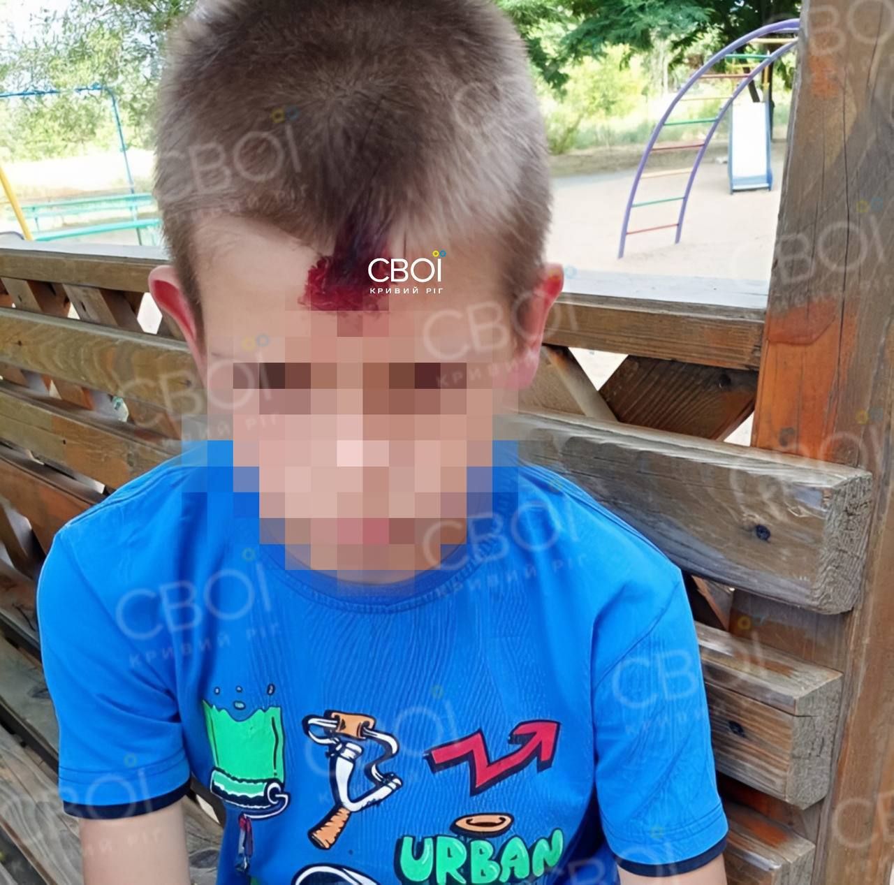 Куля влучила малому в лоб: у Кривому Розі військовий розважався стріляниною з балкону 1