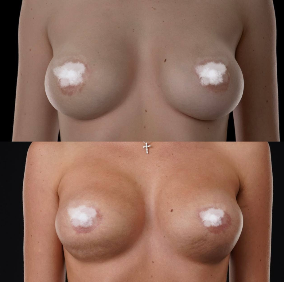 Анастасія продемонструвала помилки хірурга