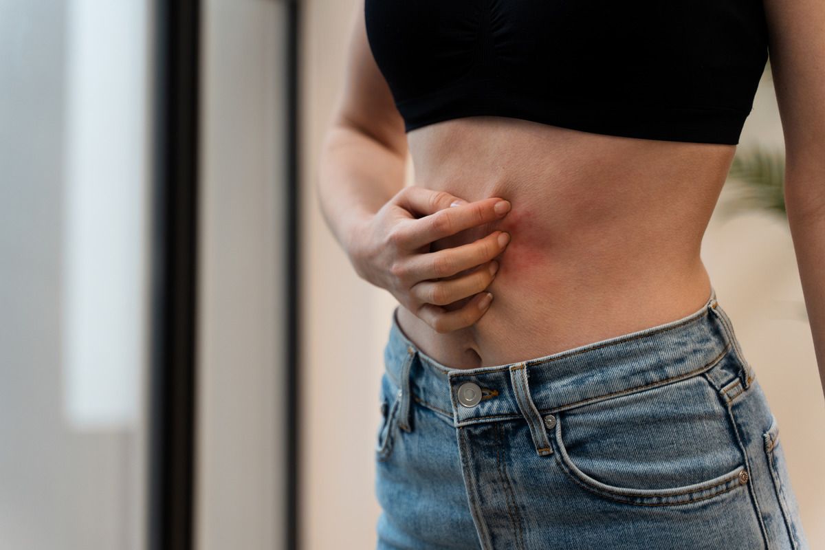 Вузькі штани можуть стати причиною грижі – правда чи міф 2