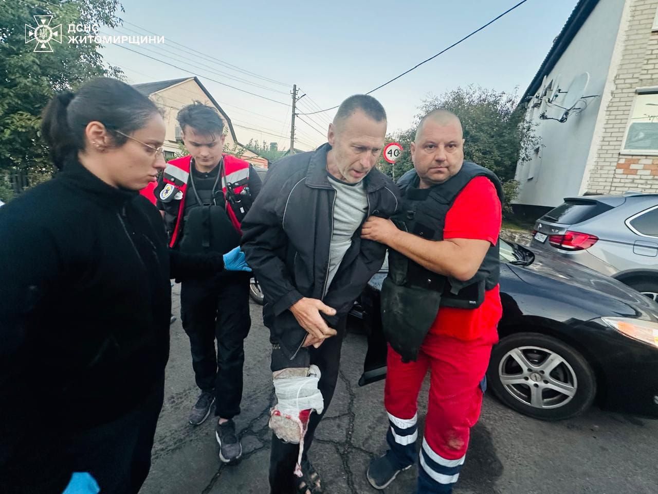 Житомирщина под обстрелами: погиб человек, еще пятеро ранены 4