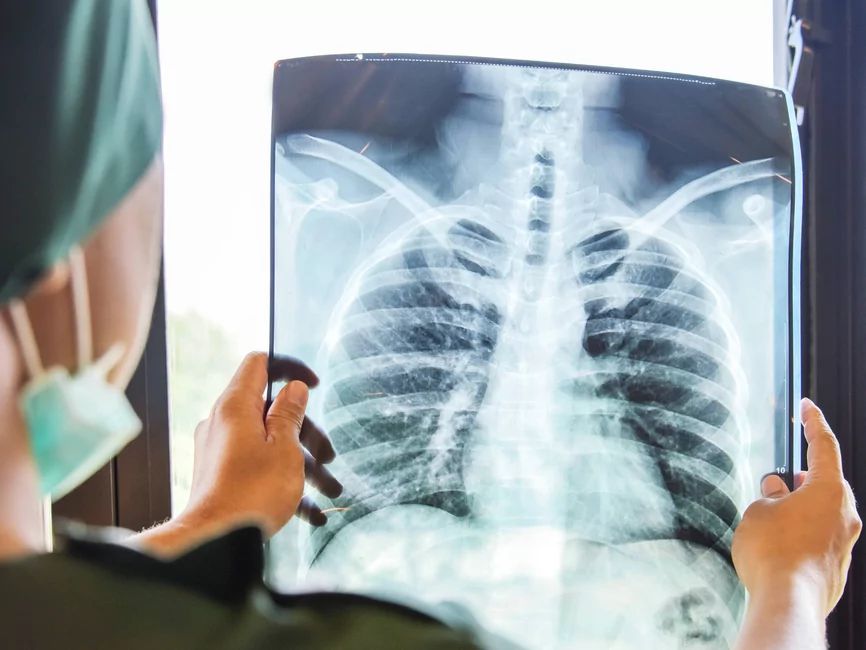 Цей день підкреслює важливість спірометрії, як методу діагностики Яке сьогодні, 14 жовтня, свято: День створення УПА та екологічної освіти 4