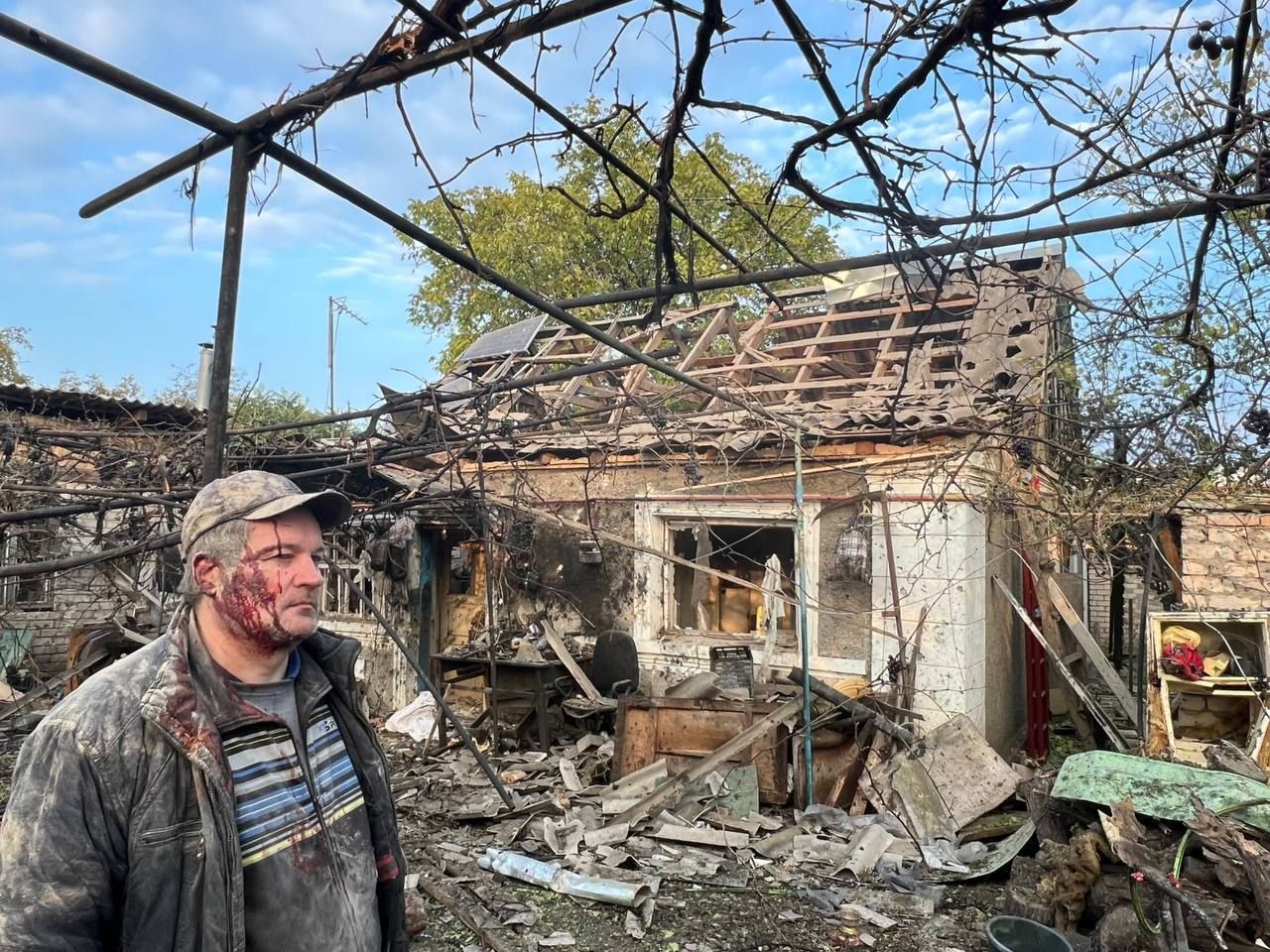 Росія знову обстріляла Херсон: загинула жінка, постраждала дитина 2