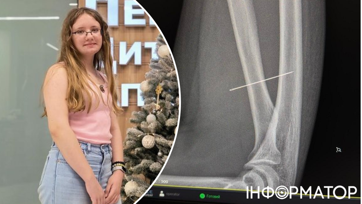 Через блекаут дівчинка зі Львова тиждень ходила з голкою в руці