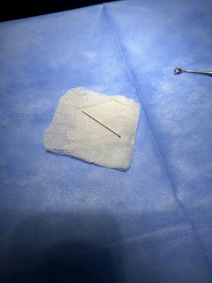 Через блекаут дівчинка зі Львова тиждень ходила з голкою в руці 3