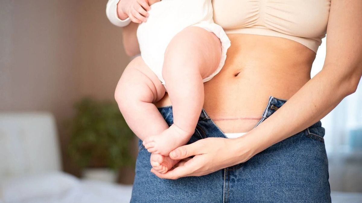 День кесаревого розтину – це свято життя, мужності та медичних інновацій Яка сьогодні, 14 січня, дата: 3