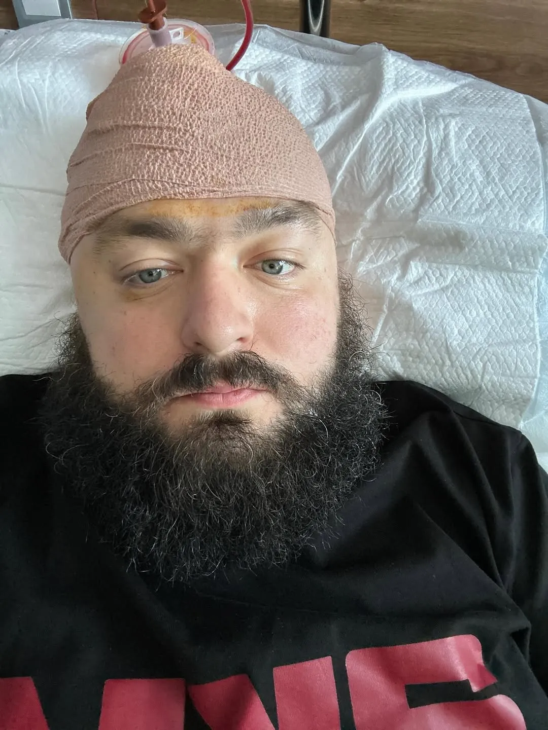 За два тижні до атаки Вєня пережив складну операцію на мозку