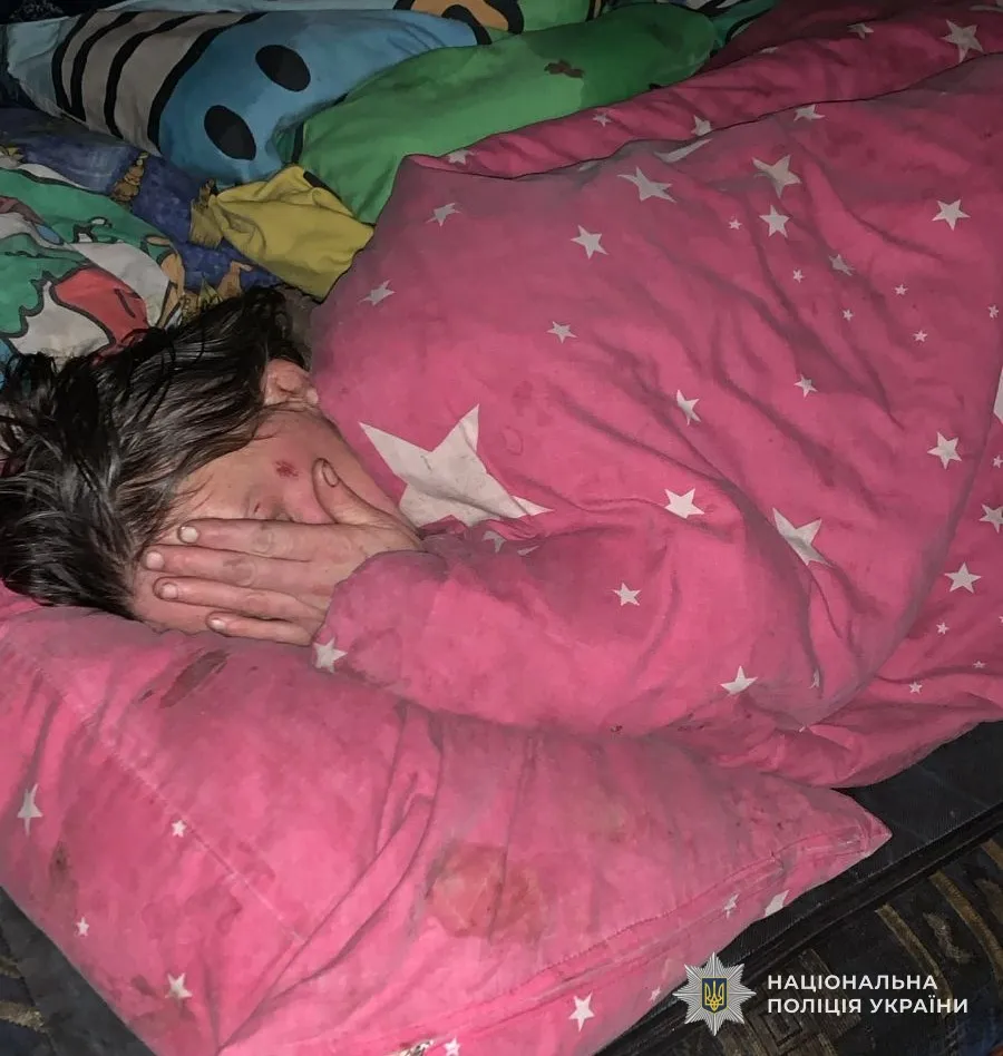 На Львівщині від переохолодження та хвороб помер дворічний хлопчик: батьків затримали, а інших дітей забрали 3