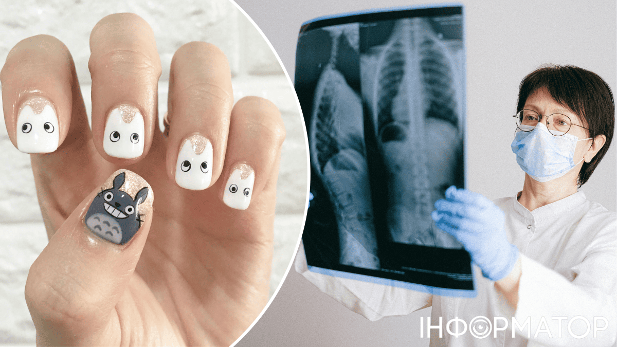 Какой сегодня, 24 марта, праздник: День фтизиатра и мастера маникюра