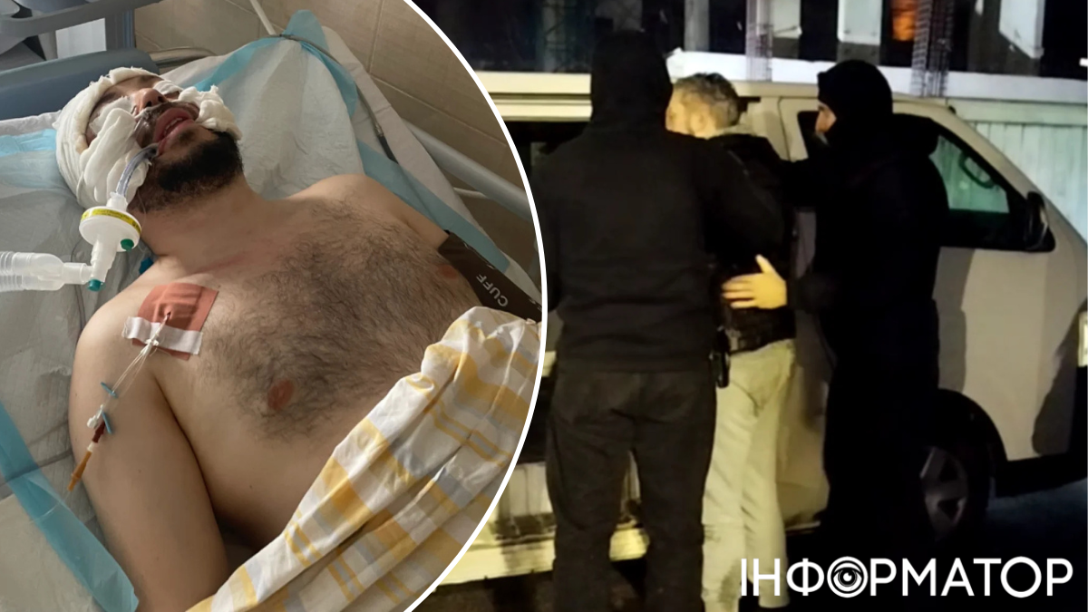 У Дніпрі чоловік впав у кому після нападу невідомих у балаклавах: шевронів не було, у ТЦК прокоментували