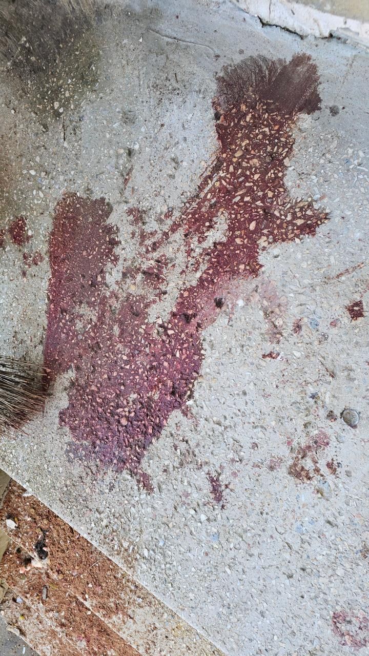 Чоловік отримав травму голови