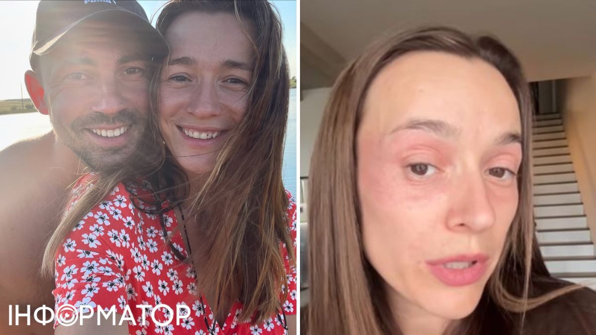 Актриса Настя Короткая изуродовала себе лицо - Я не боюсь старости, я добью себя раньше