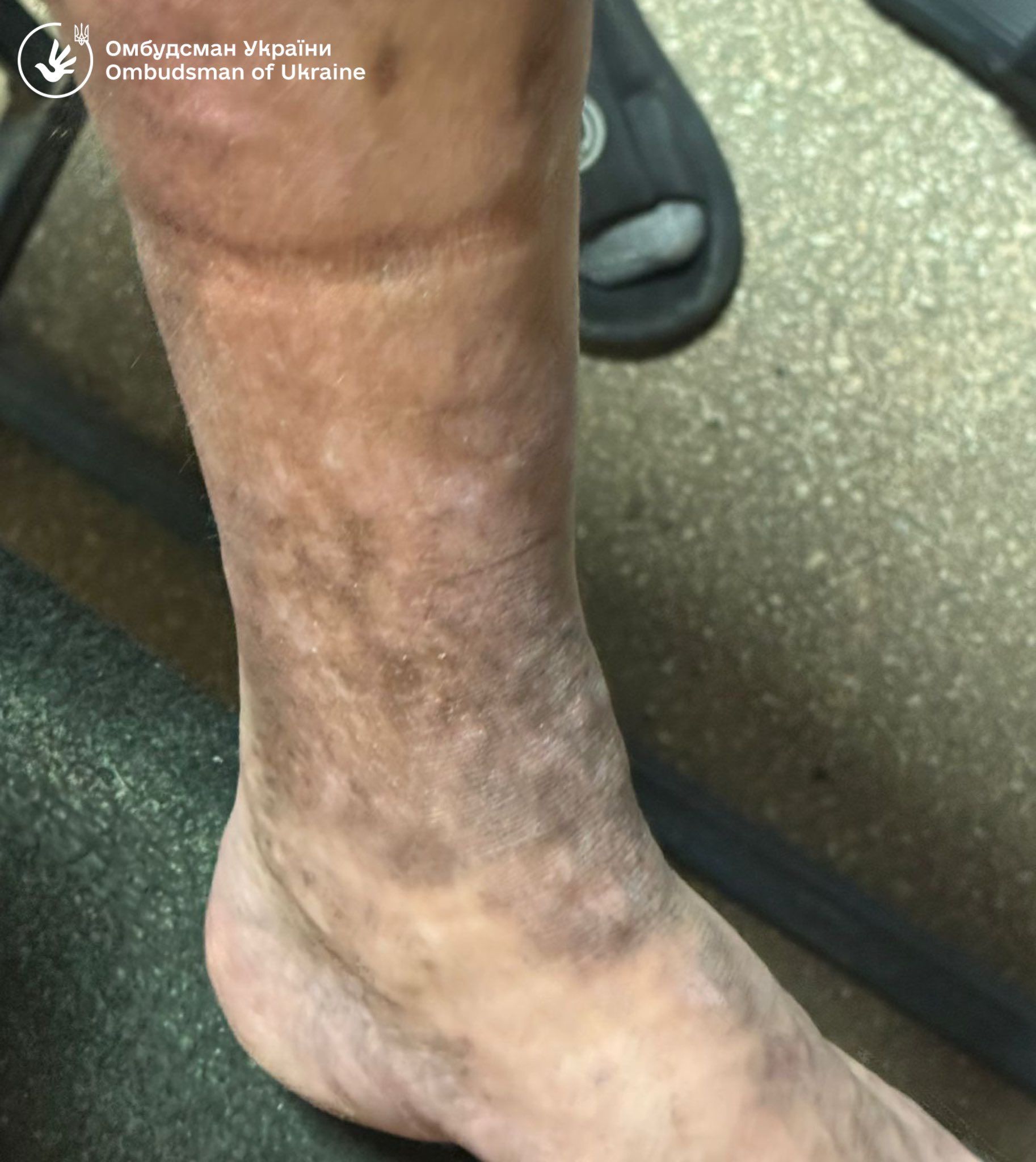 умови утримання в ТЦК