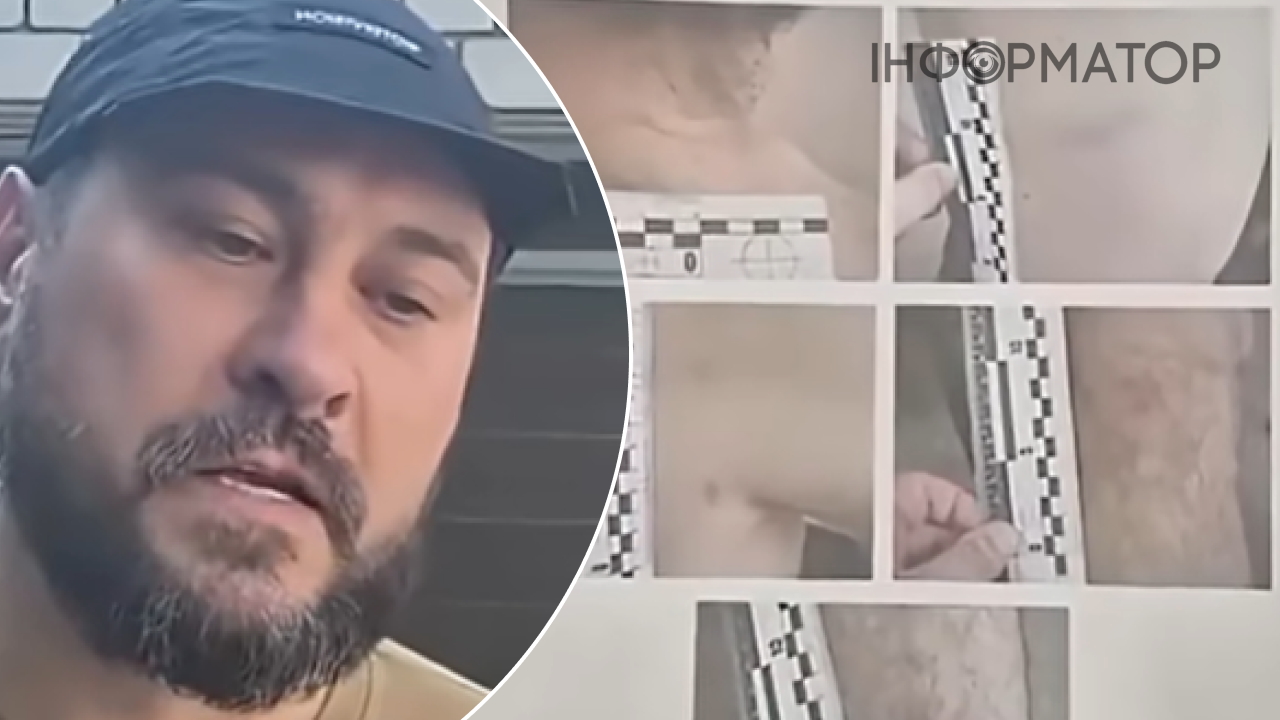 В ТЦК Днепра отрицают избиение ветерана 3-й ОШБр и заявляют, что эксвоенный с адвокатом требовали 100 тысяч долларов компенсации
