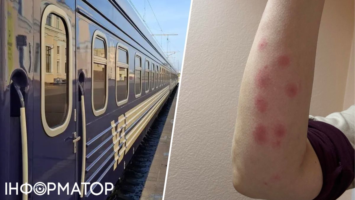 Пасажирка заявила про укуси клопів у вагоні потяга Одеса—Дніпро — що кажуть в Укрзалізниці