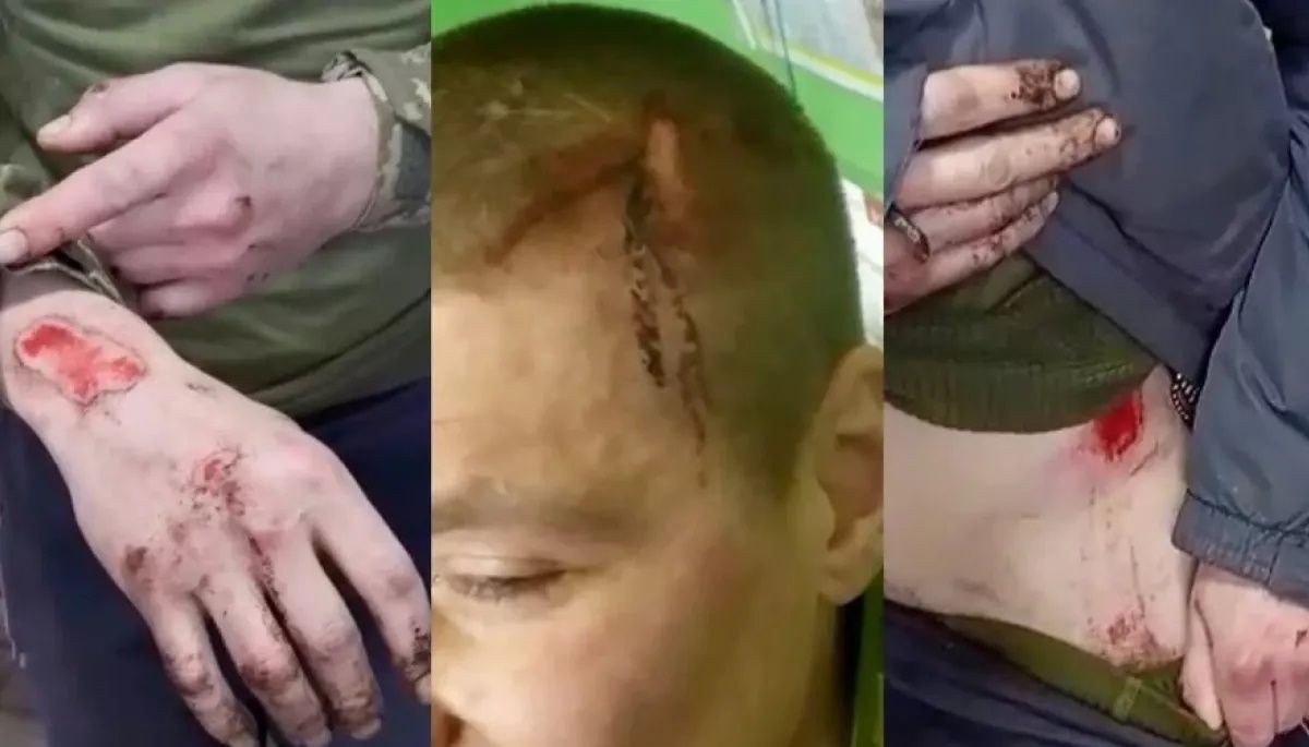 Близькі деяких загиблих заявили жуналістам Бабеля про можливе насильство