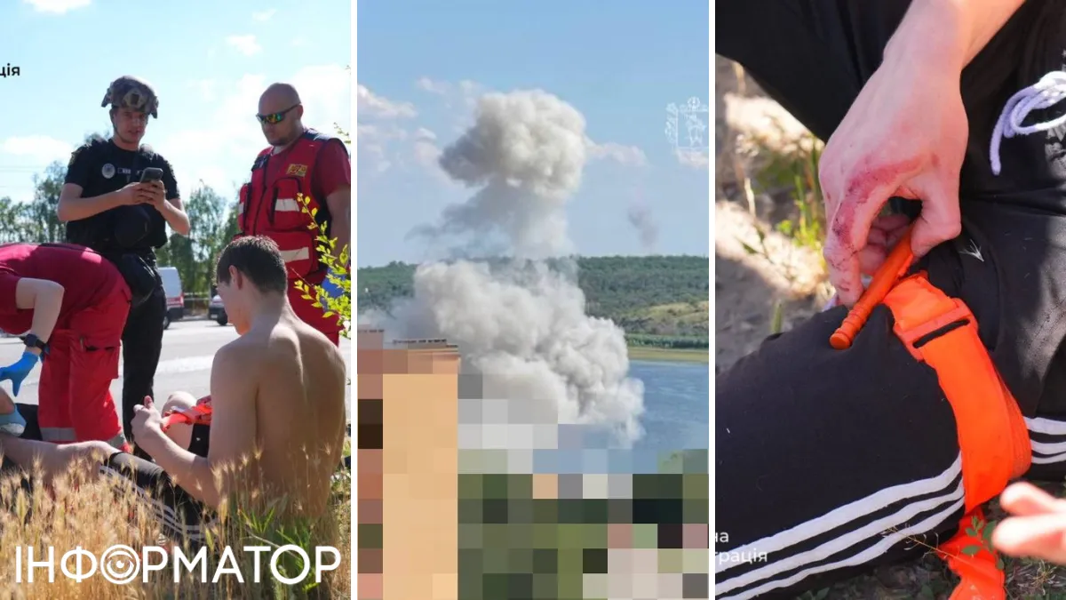 Россия убивает мирных на пляжах. В Запорожье прилет КАБа и ранения детей