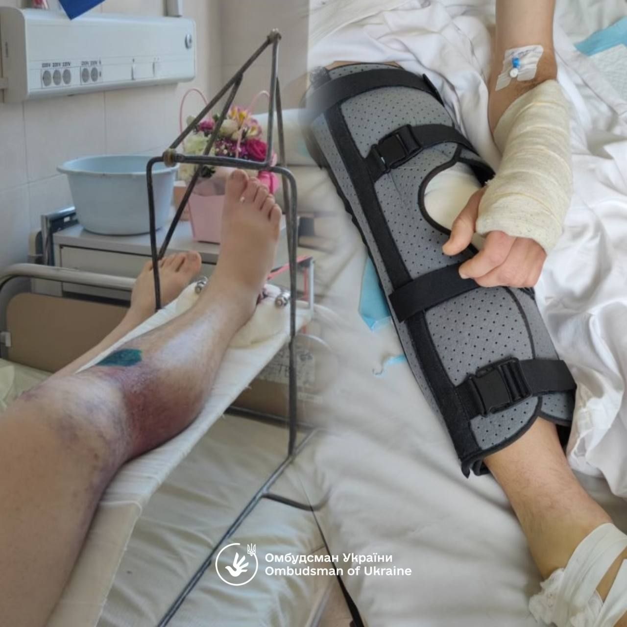 ⏺Замість «швидкої» — ТЦК: Офіс Омбудсмана ініціював розслідування інциденту в Івано-Франківську ⏺Замість «швидкої» — ТЦК: Офіс Омбудсмана ініціював розслідування інциденту в Івано-Франківську