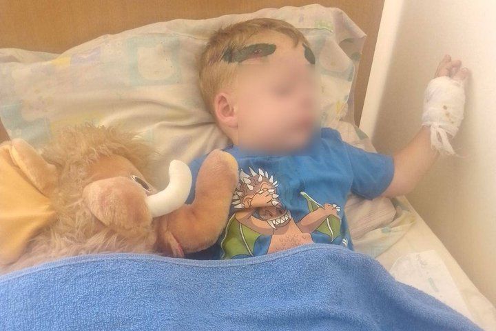 Потерпілий Роман у лікарні з множинними забоями голови, джерело: Суспільне Одеса