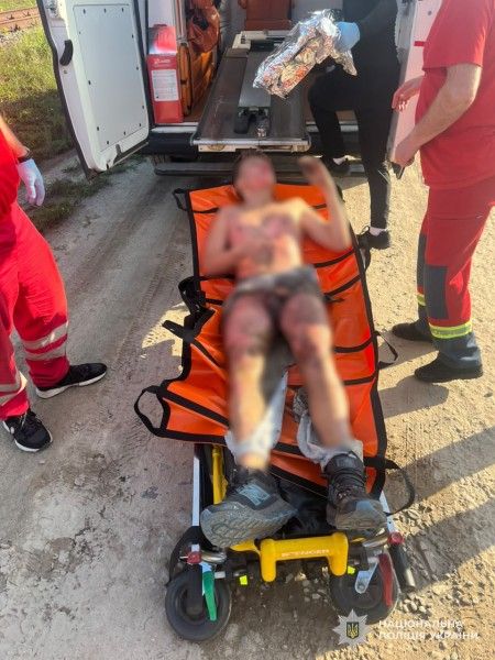 Небезпечне селфі - у Львові 13-річний хлопець заліз на вагон та опинився в реанімації 1