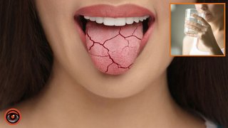Сухість у роті та постійна спрага: які хвороби можуть спричиняти цей симптом