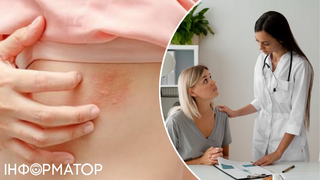 Не чіпай, а то підхопиш: головні помилки щодо плям на шкірі