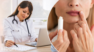 Реальний спосіб назавжди вилікувати герпес на губах – медики розкрили правду