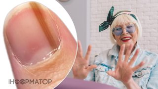 Увага: зміни на нігтях можуть бути першим сигналом діабету!